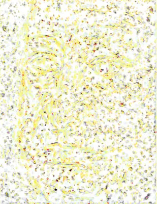 HA